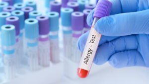 İnsan Vücut Sıvılarına Karşı Alerjiler: SPH’den Aquajenik Ürtikere Kadar Nadir Reaksiyonlar