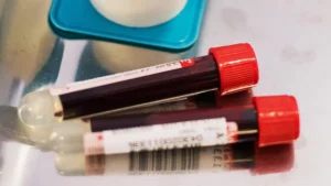 BilliontoOne: Onkoloji ve Prenatal Testleri İçin 48.5 Milyon Dolarlık Yatırım Turunu Tamamladı