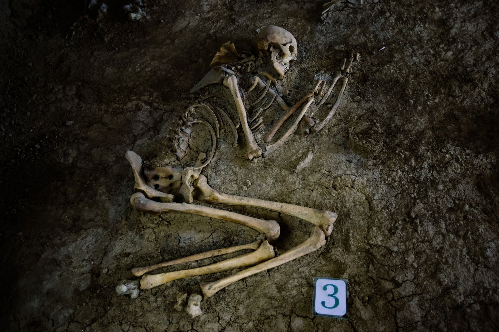 İskeletlerden Cinsiyet Tahmini: Yöntemler, Doğruluk ve Toplumsal Yansımalar