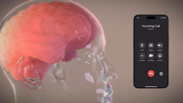 Neuralink: Zihnin Yazıya Dönüşmesini Hedefleyen Klinik Denemeler ve Geleceğin İletişim Paradigması