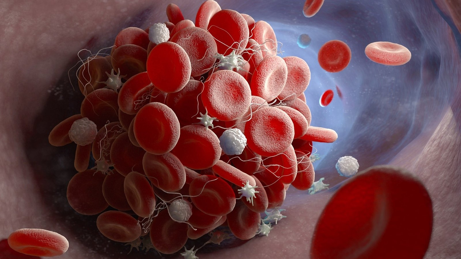 Adenovirüs Tabanlı Aşılarda VITT: Genetik Yatkınlık ve Rastlantısal Mutasyonun Çatışması