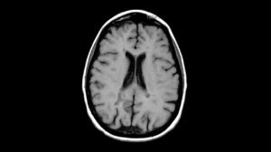 Prima: Beyin MR’larında Anında Analiz ve Yüksek Doğrulukla Tanı Koyan Yeni Yapay Zeka Modeli