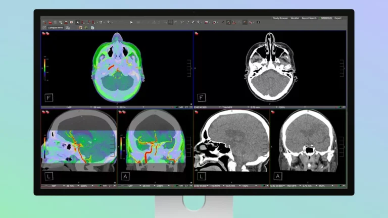 Studio Display XDR ile Medikal Görüntülemede Yeni Bir Dönem