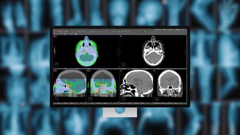 Studio Display XDR ile Tıbbi Görüntülemede Yeni Bir Denge: DICOM Uyumlu Monitör